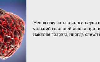 Если болит голова когда ее поворачиваешь