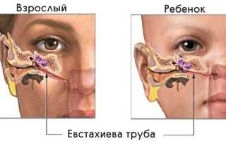 Если в самолете болят уши и голова