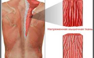 Что делать если продуло спину и болит