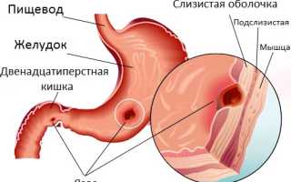 Болит со спины и вниз живота