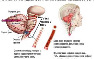Долго болит левая сторона головы