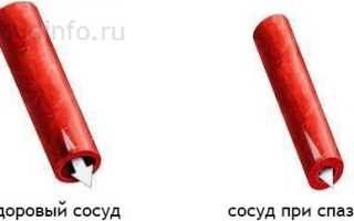 Болит голова спазмы сосудов