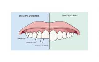 Болит затылок головы и челюсть