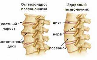 Болит левая затылочная часть головы причины