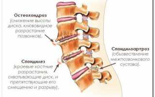 Если болит спина жестко