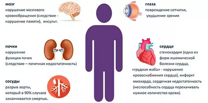 Давление 170 и болит голова что делать