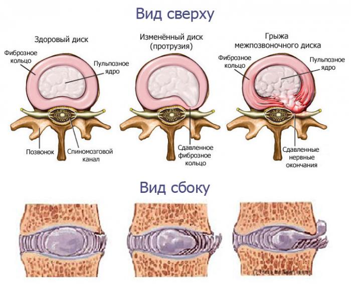 Не могу долго стоять на ногах болит спина