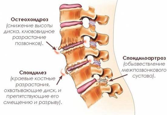 Не могу долго стоять на ногах болит спина
