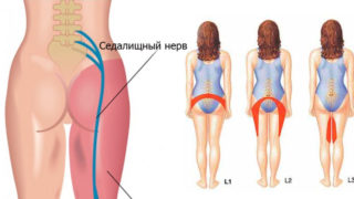 Болит спина и мышцы паха