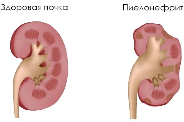 Почему болит поясница ночью лежа на спине