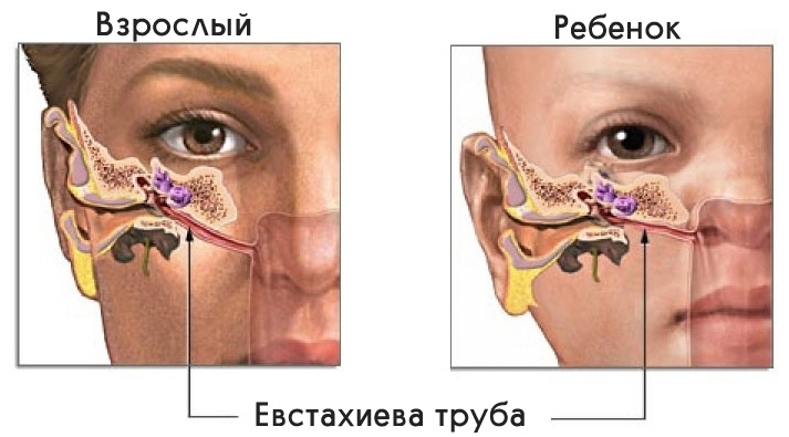 евстахиева труба