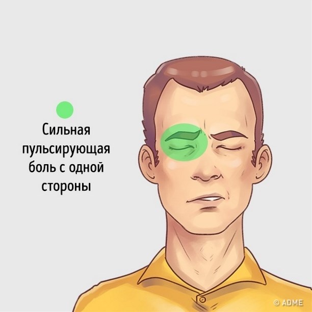 Безумно болит голова почему