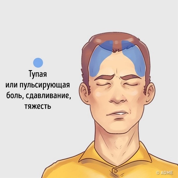 Безумно болит голова почему