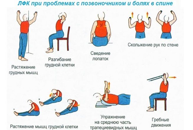 ЛФК при проблемах с позвоночником и болях в спине