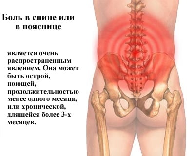болит спина возможные причины