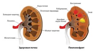 Болит под левым подреберьем отдает в спину