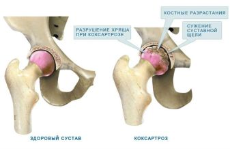 Болит спина и мышцы паха