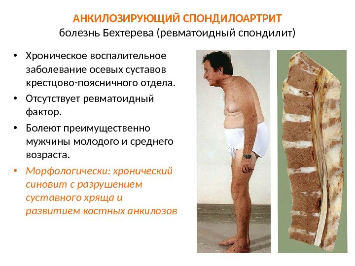 Утром просыпаюсь болит спина