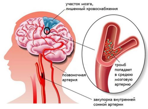 Мозг