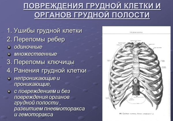 Варианты травм грудной клетки