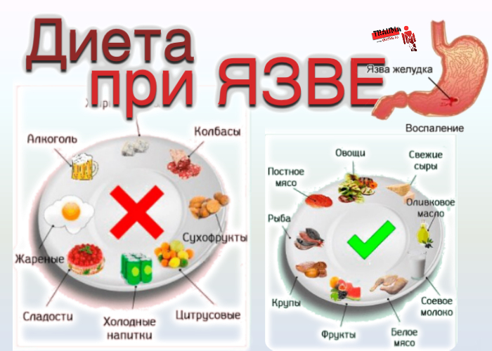 Почему после приема пищи болит спина