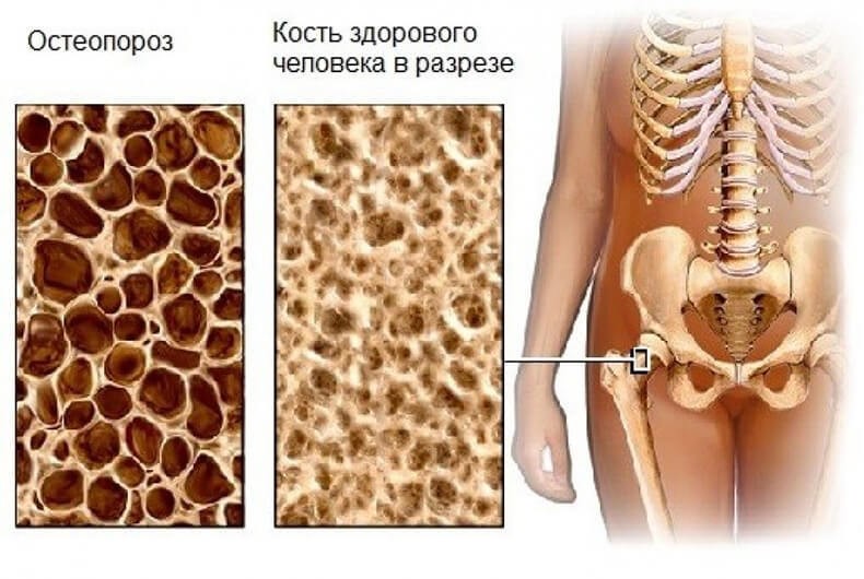 Почему болит поясница ночью лежа на спине