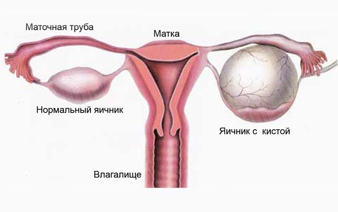 почему болит спина после месячных как при месячных