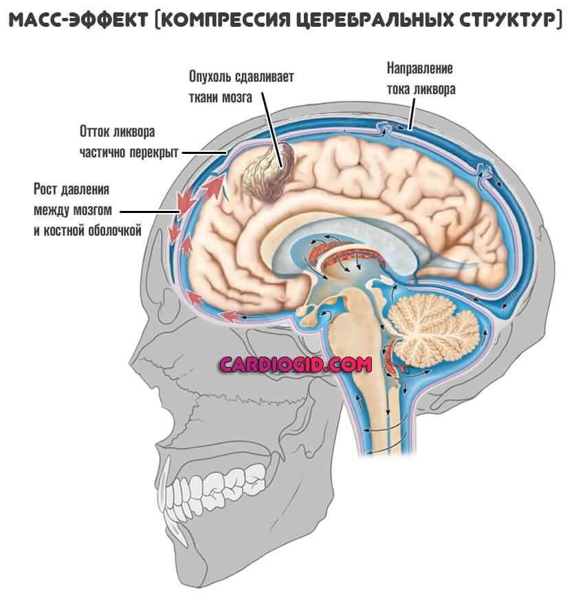 масс-эффект