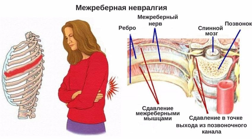 Болит под левым подреберьем отдает в спину