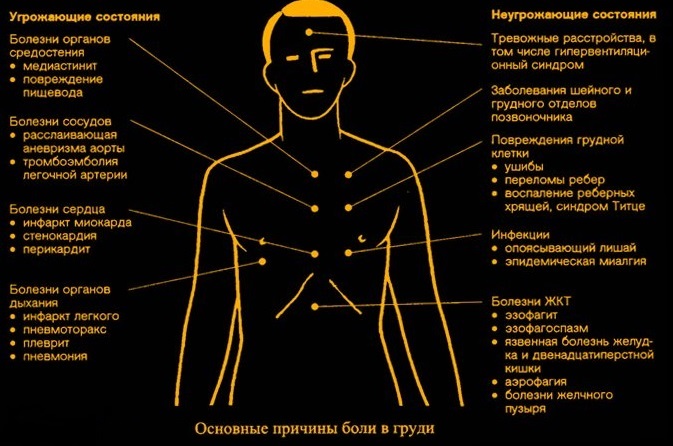 Из-за чего может болеть в груди