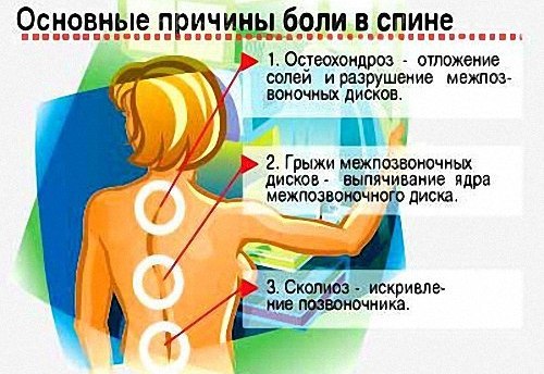 Основные причины боли в спине