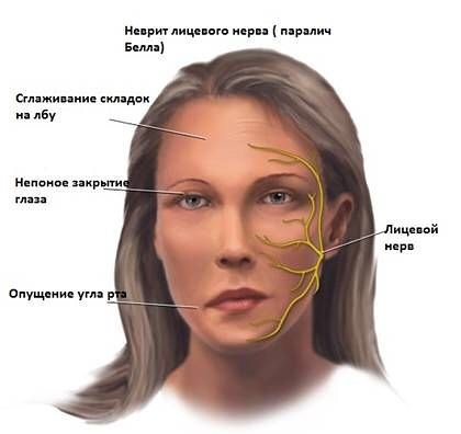 Почему немеет голова
