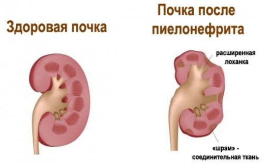 Болит низ спины у женщины причины