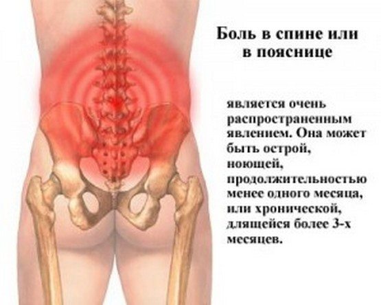 Боли в спине и пояснице